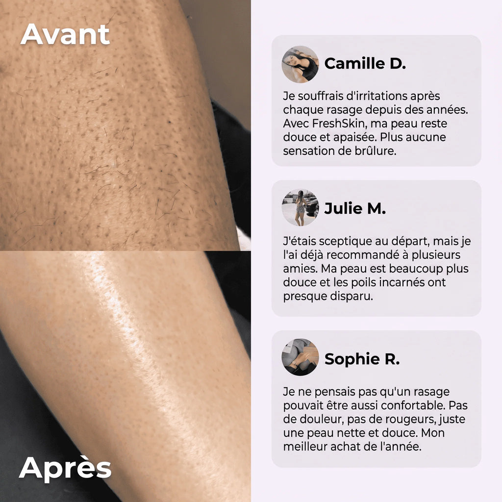 FreshSkin - Rasoir anti poils incarnés