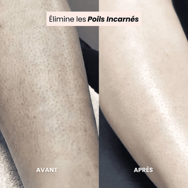 FreshSkin - Rasoir anti poils incarnés