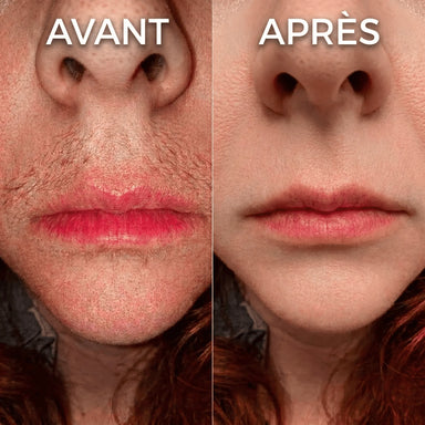 PureSkin - Sérum lissant anti-repousse de poils