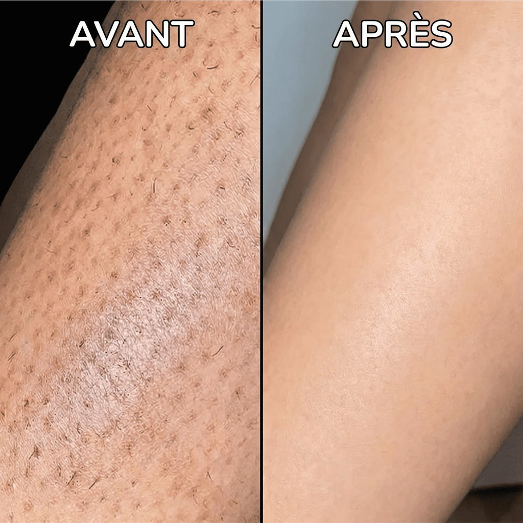 PureSkin - Sérum lissant anti-repousse de poils