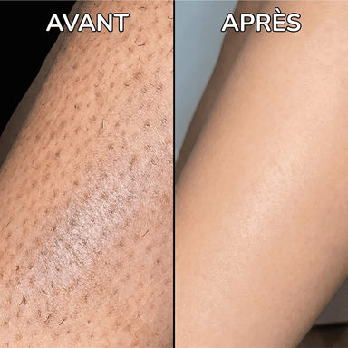 PureSkin - Sérum lissant anti-repousse de poils