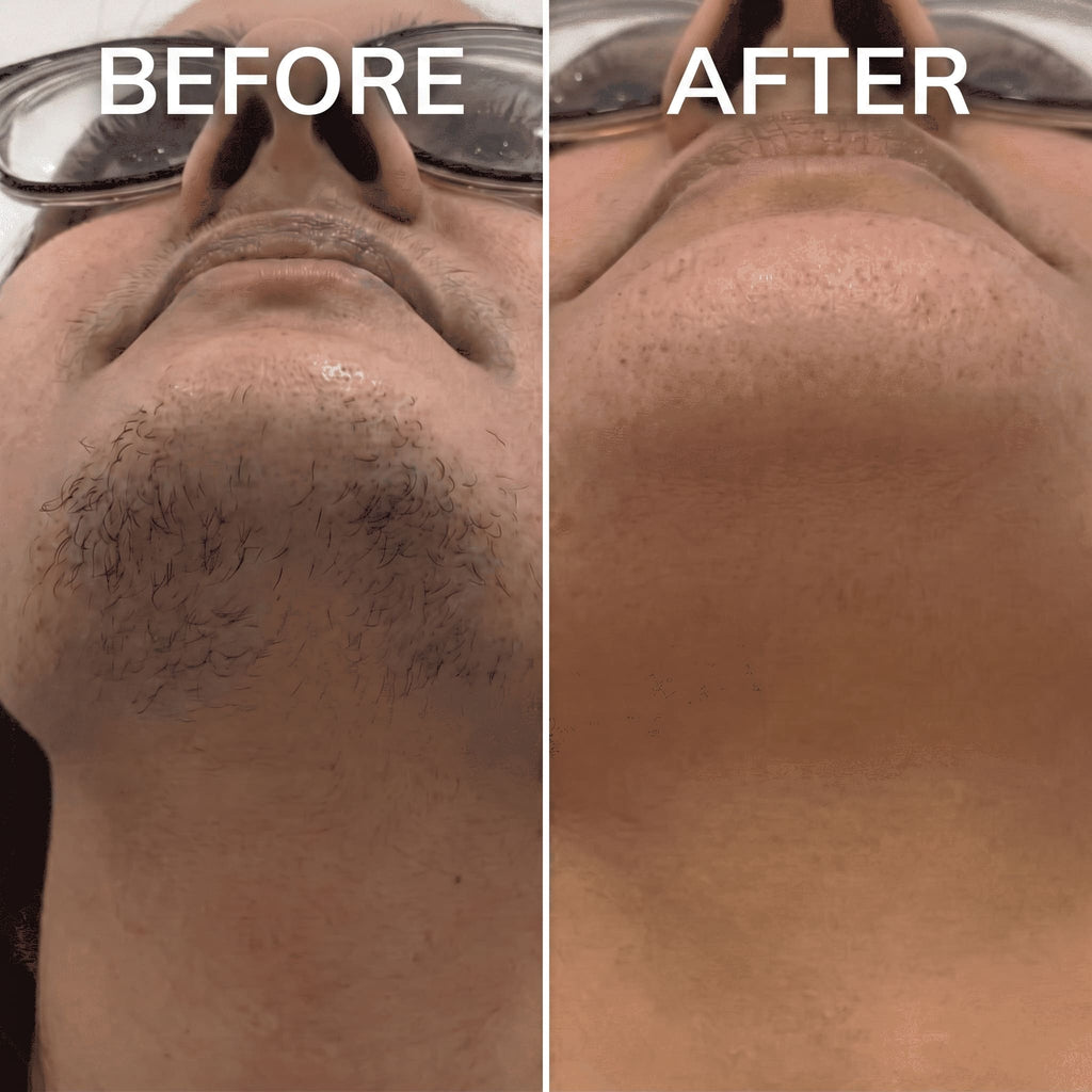 PureSkin – Hair Minimizing Smoothing Serum