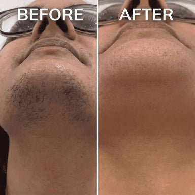 PureSkin – Hair Minimizing Smoothing Serum