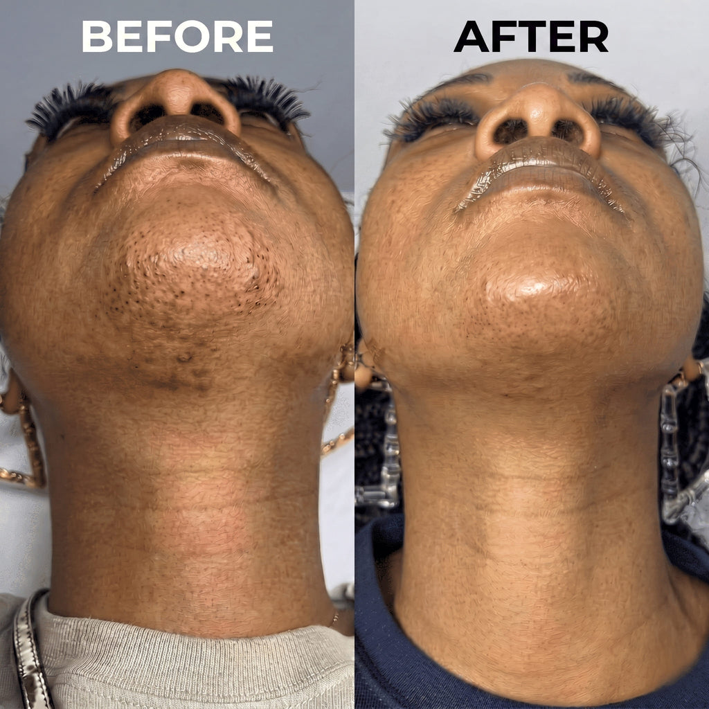 PureSkin – Hair Minimizing Smoothing Serum