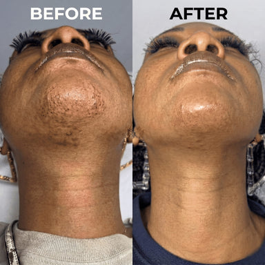 PureSkin – Hair Minimizing Smoothing Serum