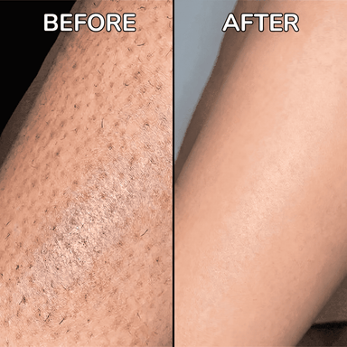 PureSkin – Hair Minimizing Smoothing Serum